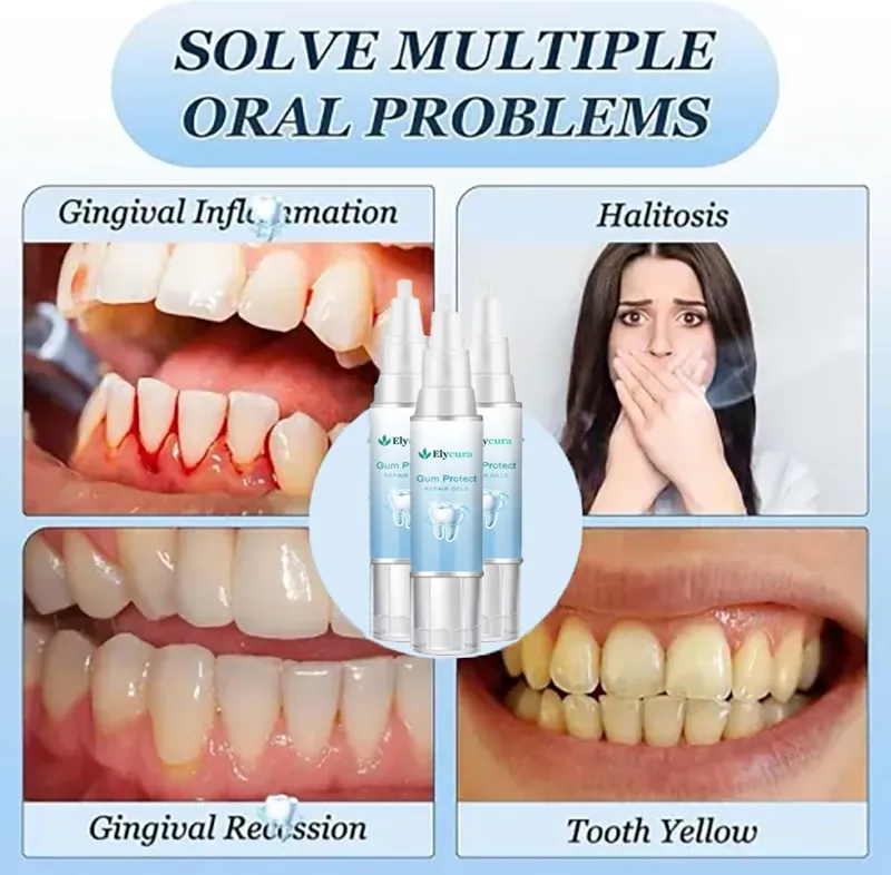 Elycura™ — Stop Gum Recession and Bleeding Without Painful Surgery