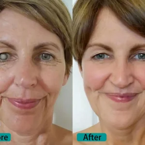 Elycura™ NANO Eye Drops