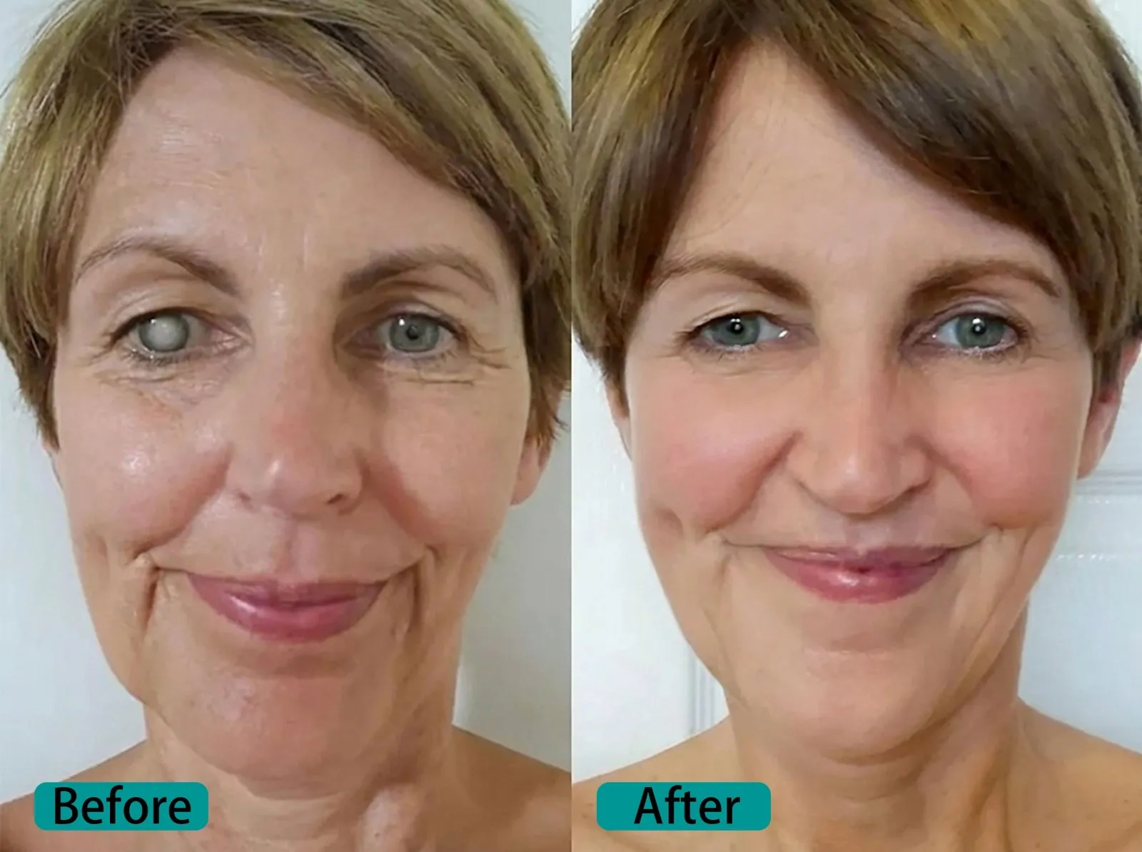 Elycura™ NANO Eye Drops