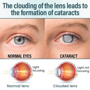 Elycura™ NANO Eye Drops