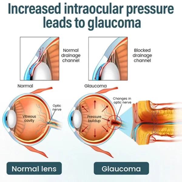 Elycura™ NANO Eye Drops