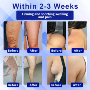 Elycura™ Lymphatic Drainage Massage Cream