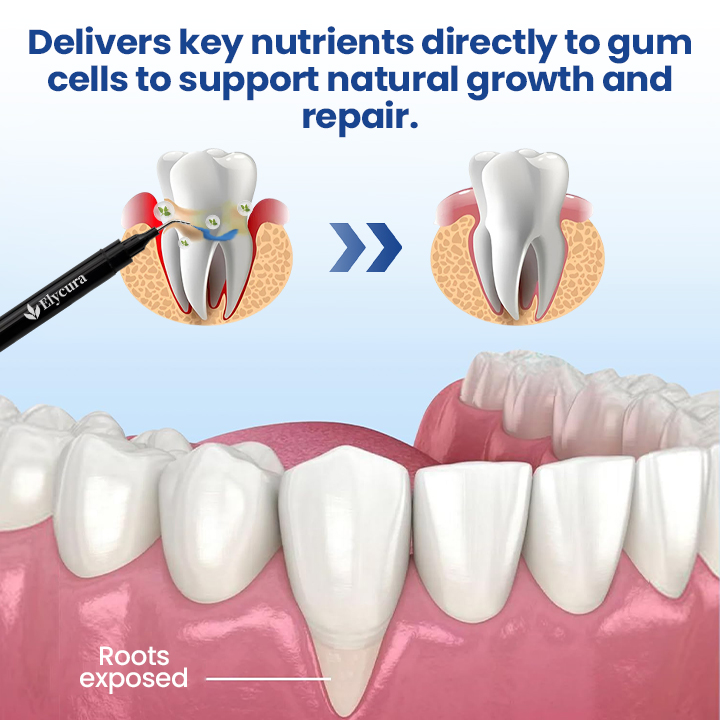 Elycura™ Gum Care Solution | Finally—A Non-Surgical Solution