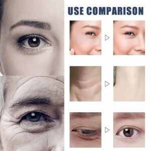 Elycura Women in Their 40s freshened up