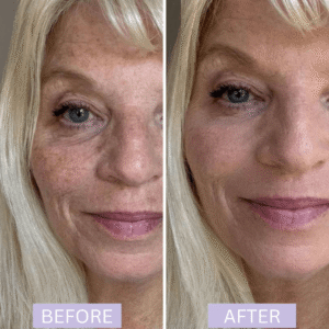 Elycura Women in Their 40s freshened up