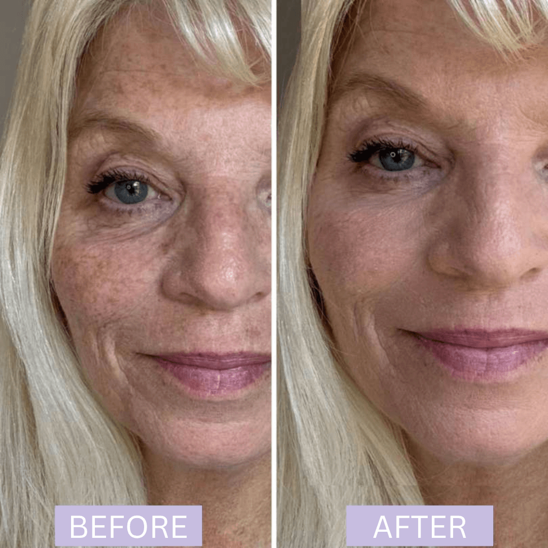 Elycura Women in Their 40s freshened up