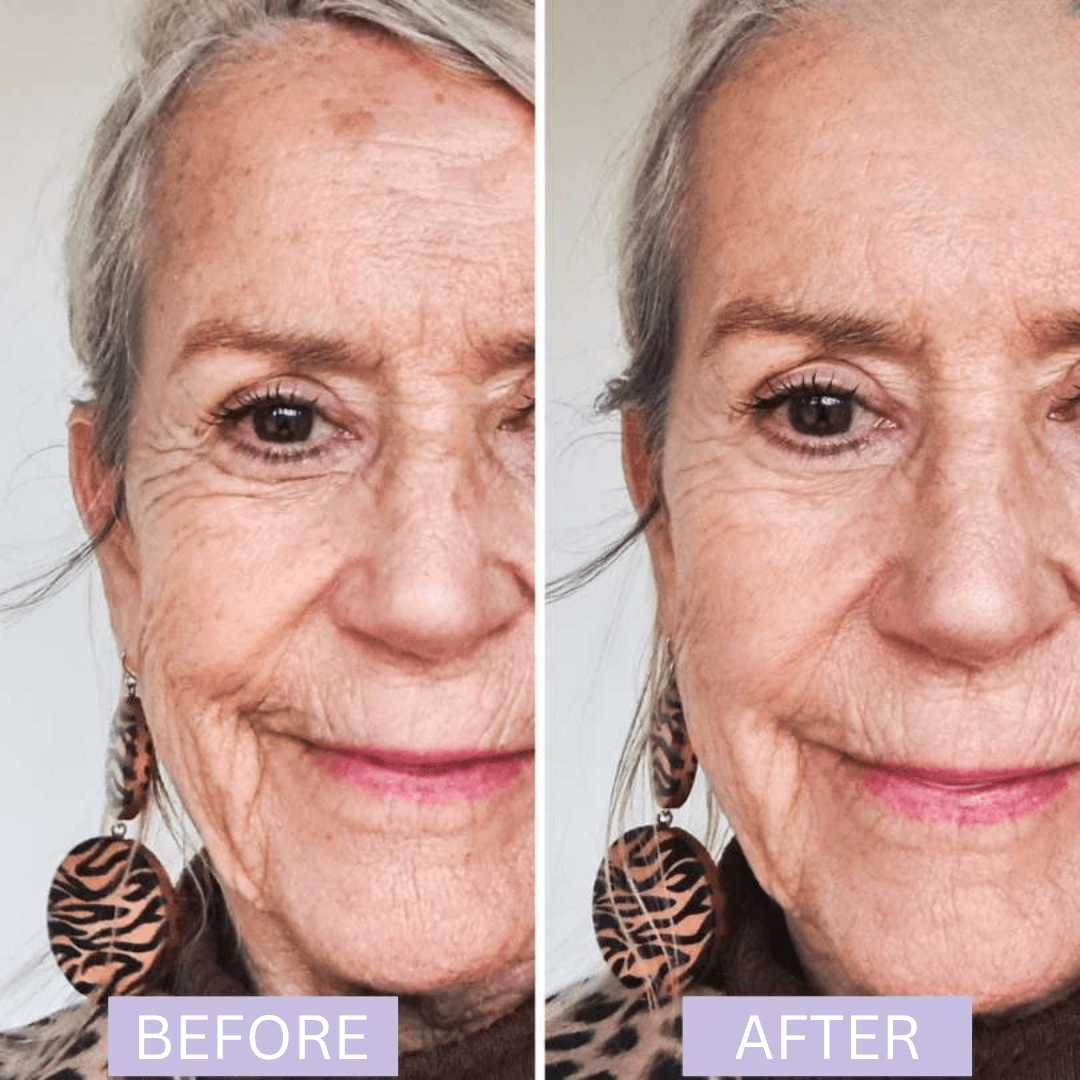 Elycura Women in Their 40s freshened up